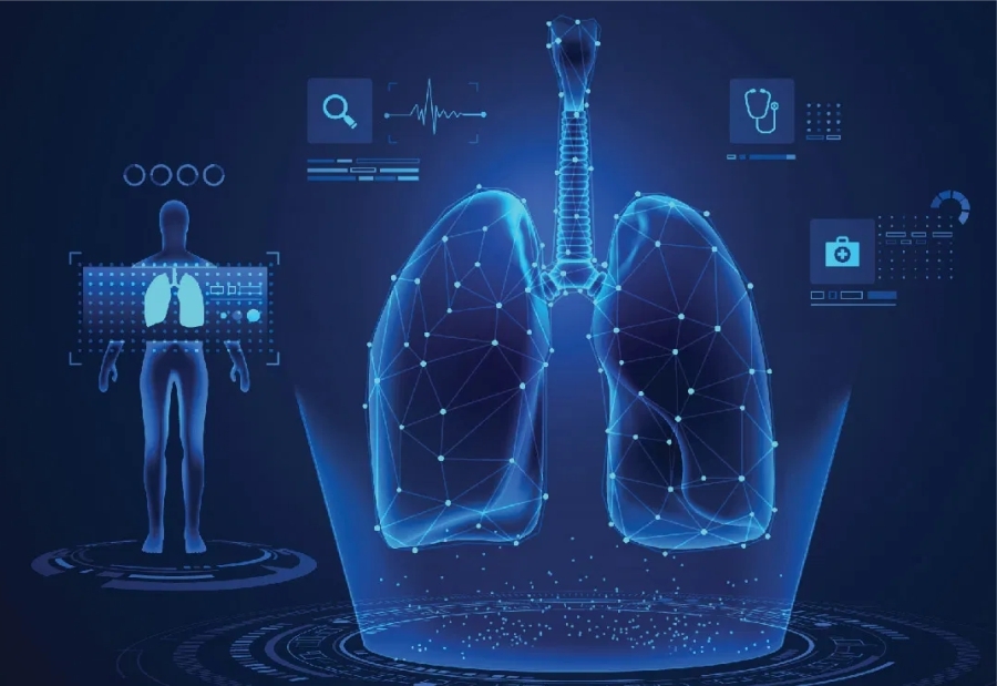 inteligência artificial para analisar pulmões